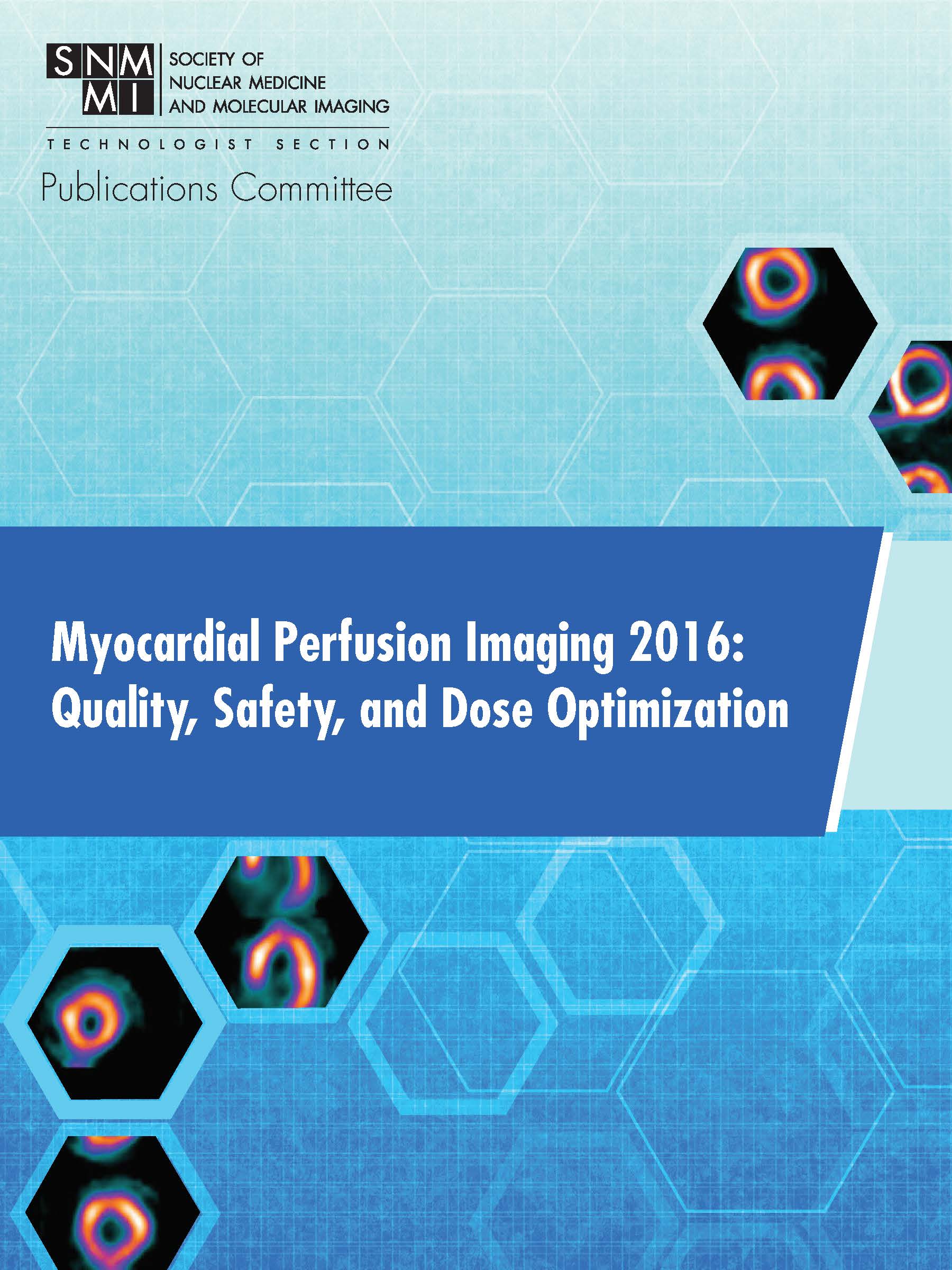 Myocardial Perfusion Imaging 2016: Quality, Safety, and Dose